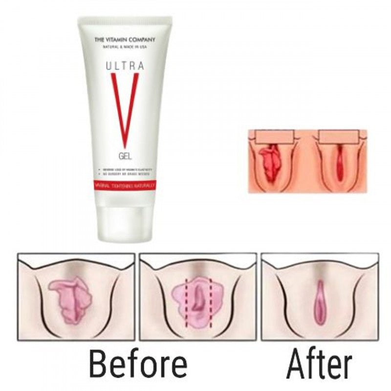 Bundle Deal- 02 (Vaginal Tightening Cream & Ecrin Hair Removel)